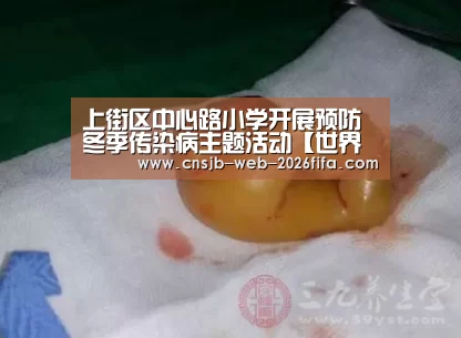 上街区中心路小学开展预防冬季传染病主题活动【世界杯外围买球】(图2) 2026世界杯